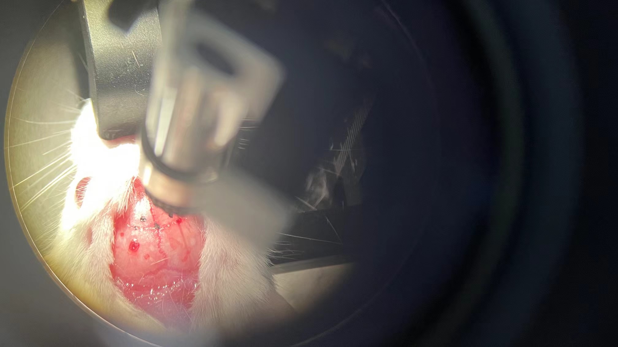 My first AAV injection