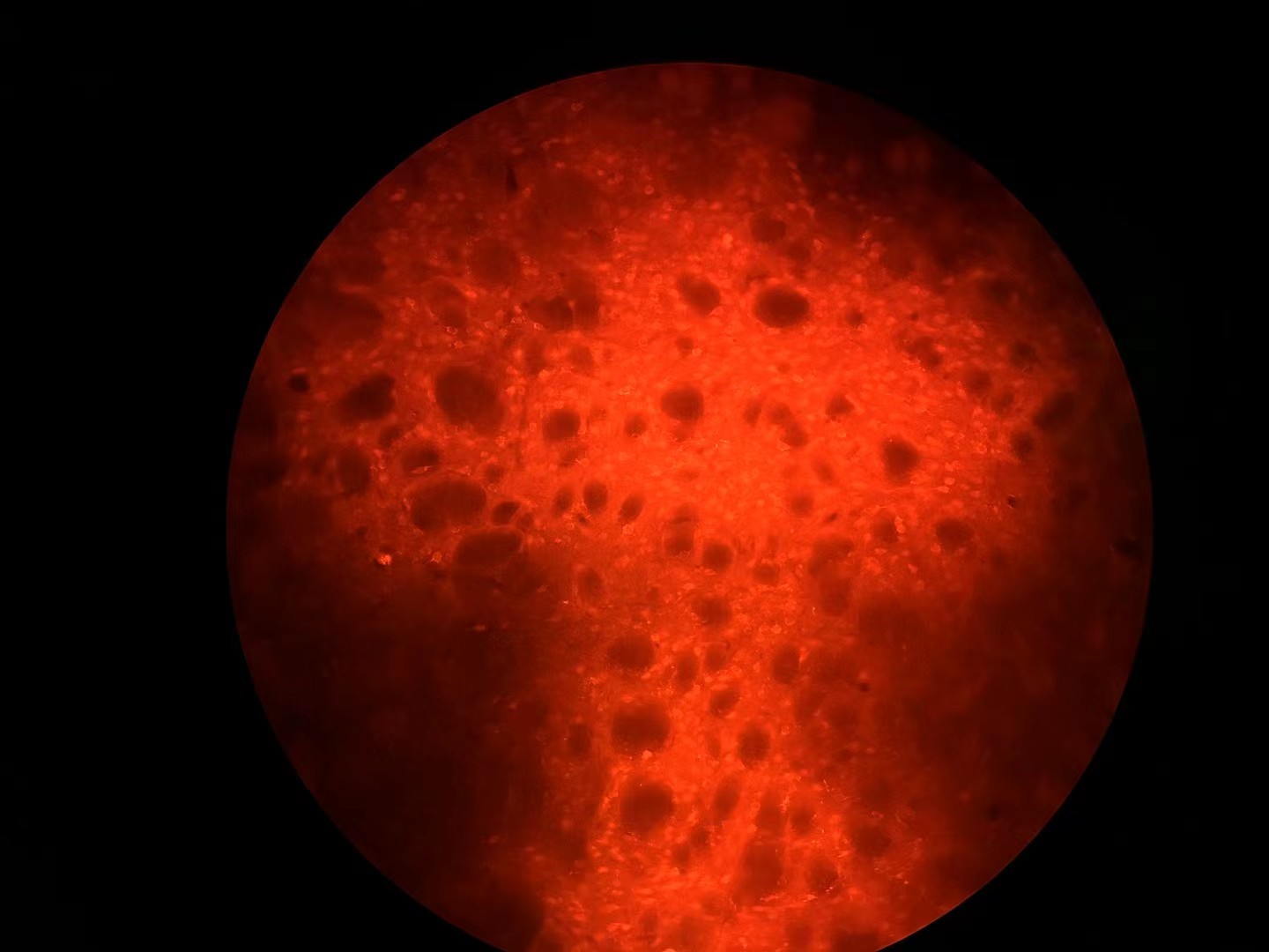 Visualization of striatum work